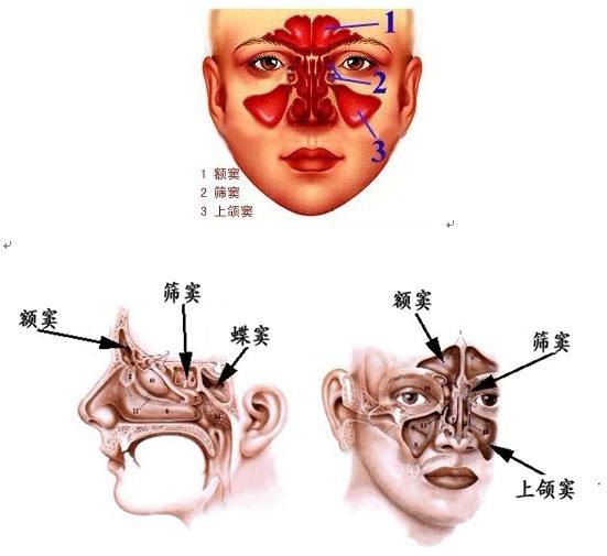 筛窦炎的症状及原因