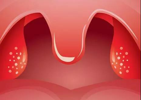 重庆扁桃体炎医院