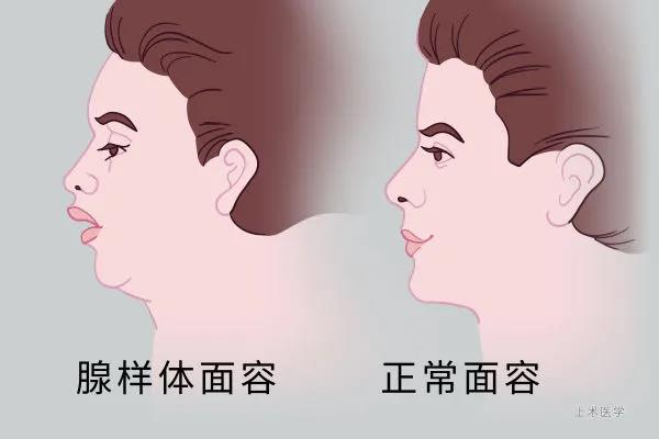 重庆专业耳鼻喉医院