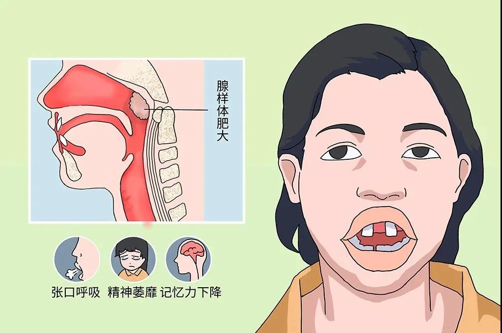 重庆耳鼻喉科医院